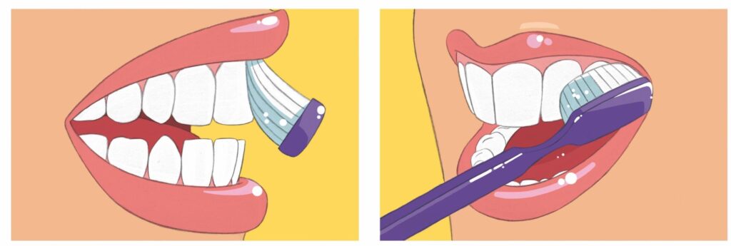 cepillado-dientes-mg