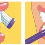 cepillado-dientes-mg
