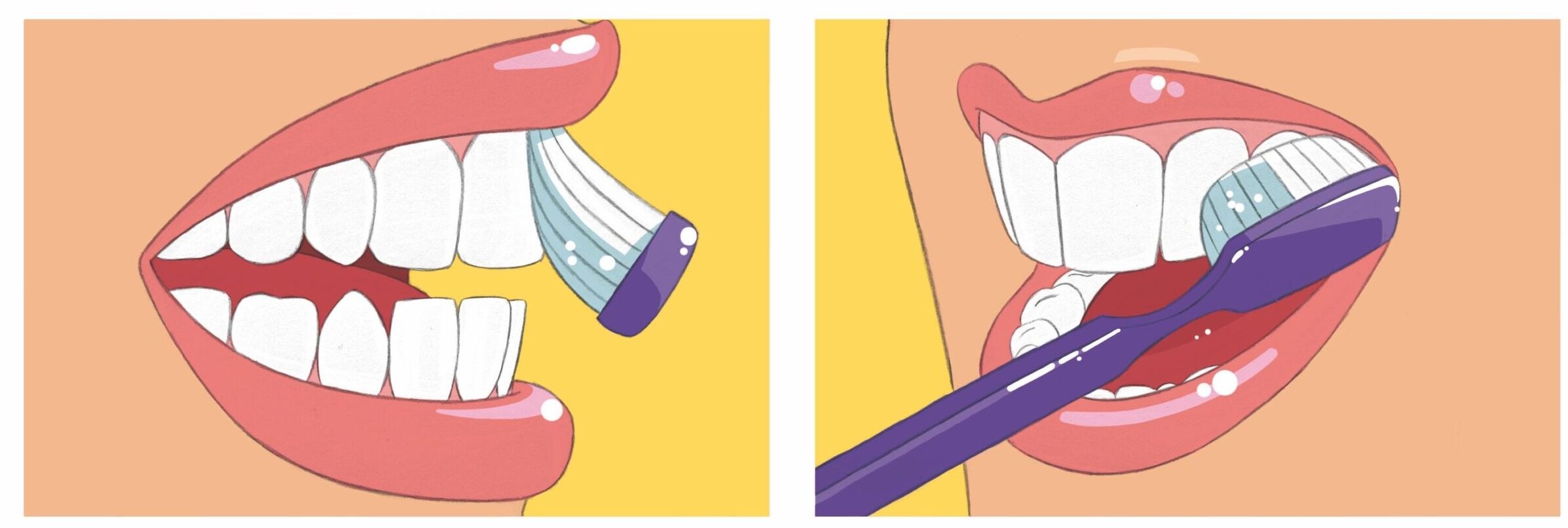 cepillado-dientes-mg