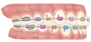 especialistas en ortodoncia en vigo 30 años de experiencia